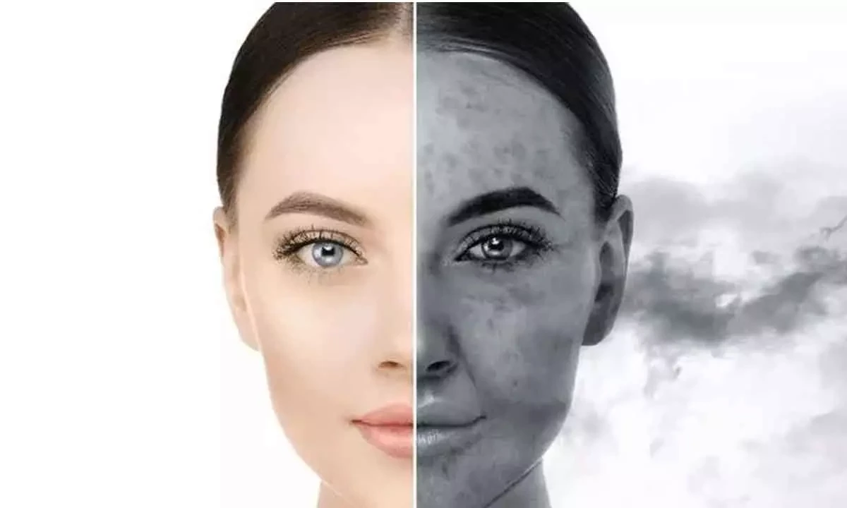 محافظت از پوست در روزهای آلوده | پرسش های متداول